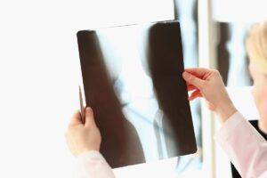 Medico con lastra raggi x