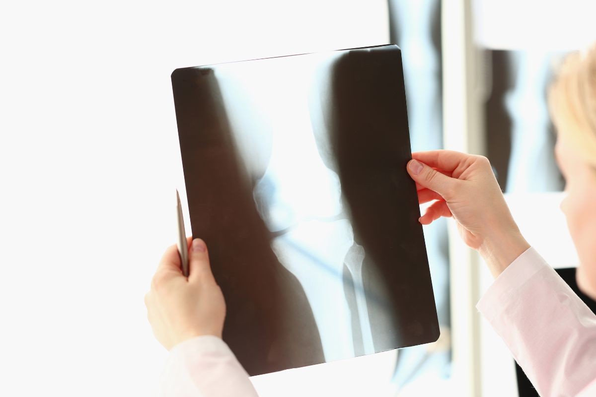 Medico con lastra raggi x