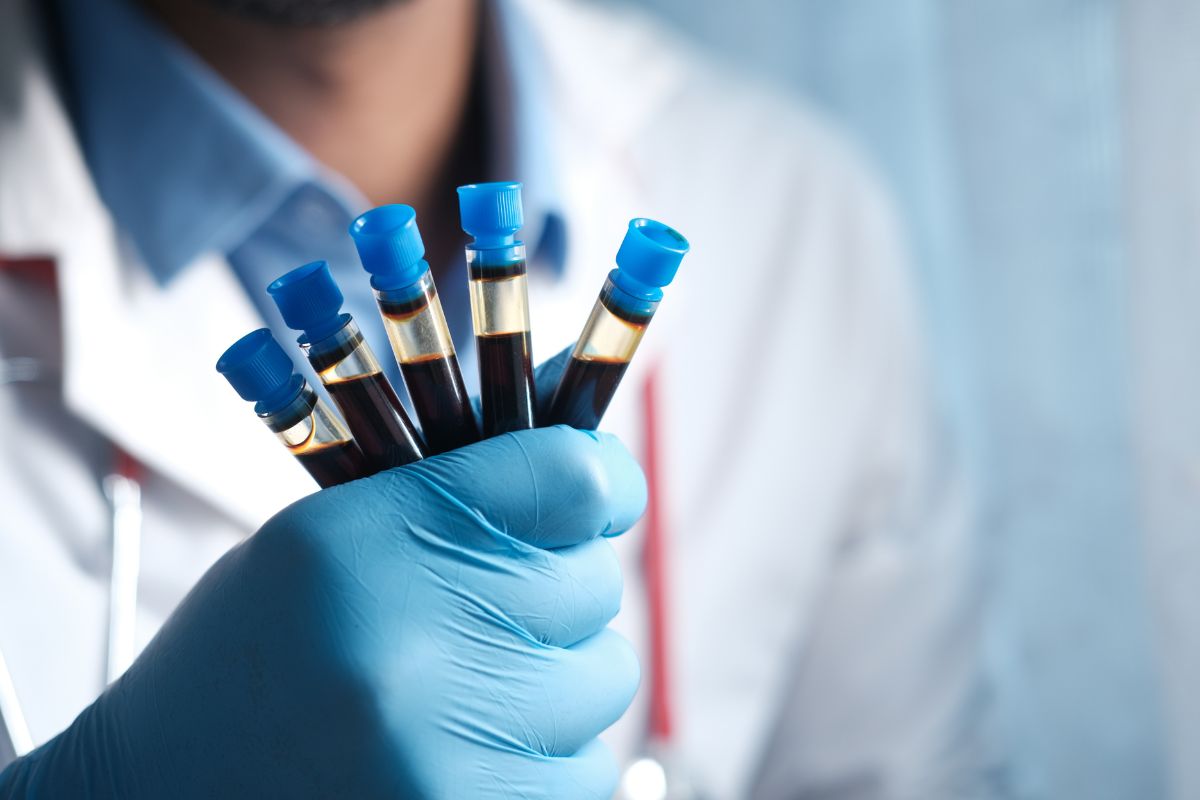 Medico con provette di sangue
